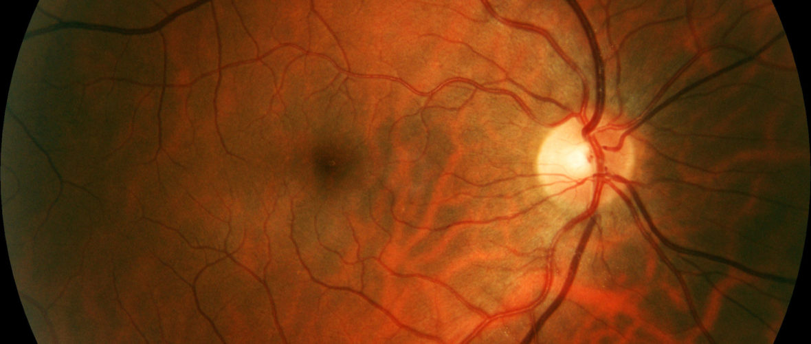 So funktioniert der Sehnerv des Auges So funktioniert der Sehnerv des Auges