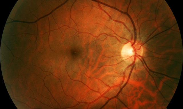 So funktioniert der Sehnerv des Auges